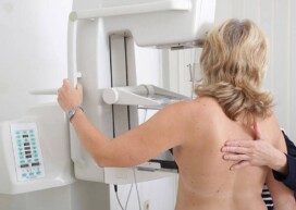 frequence-mammographie-age-tous-les-combien-centre-radiologie-imagerie-medicale-cimi-centre-imagerie-medicale-paris-13-radiologue-paris