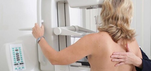 frequence-mammographie-age-tous-les-combien-centre-radiologie-imagerie-medicale-cimi-centre-imagerie-medicale-paris-13-radiologue-paris
