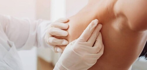 mammographie-douleurs-apres-avis-paris-cabinet-radiologie-centre-imagerie-paris-cimi-centre-imagerie-medicale-paris