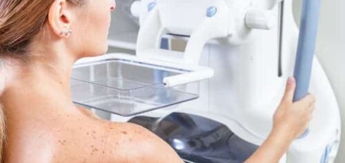 mammographie-paris-quel-age-prevention-depistage-cimi-radiologue-paris-13