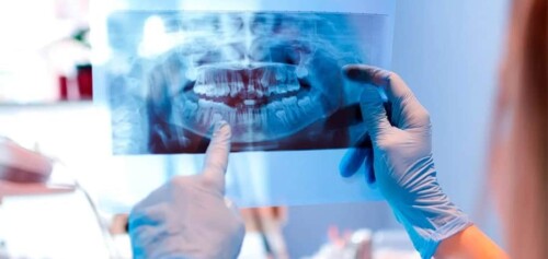 ou-faire-une-radio-panoramique-autour-de-moi-dentaire-centre-radiologie-imagerie-medicale-cimi-centre-imagerie-medicale-paris-13-radiologue-paris