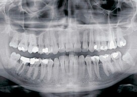 radio-dentaire-enceinte-cimi-centre-radiologie-imagerie-medicale-radiologie-paris
