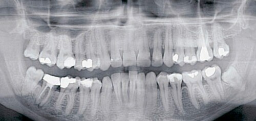 radio-dentaire-enceinte-cimi-centre-radiologie-imagerie-medicale-radiologie-paris