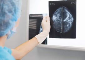resultat-mammographie-centre-radiologie-imagerie-medicale-paris-cimi-centre-imagerie-medicale-paris-13-radiologue-paris